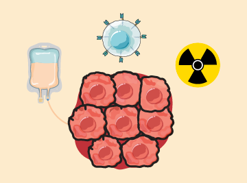 Icoon dat de initiële behandelrespons voor lymfeklierkanker vertegenwoordigt